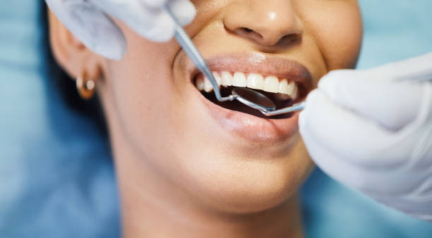 Best 24-Hour Emergency Dentist in Menard, TX